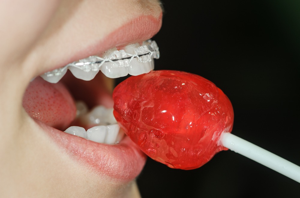 La relation entre l’alimentation et la santé bucco-dentaire